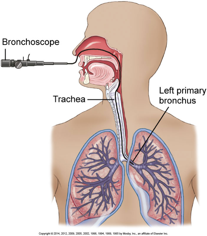 endoscopy-medical-terminology-diagnostic-procedure