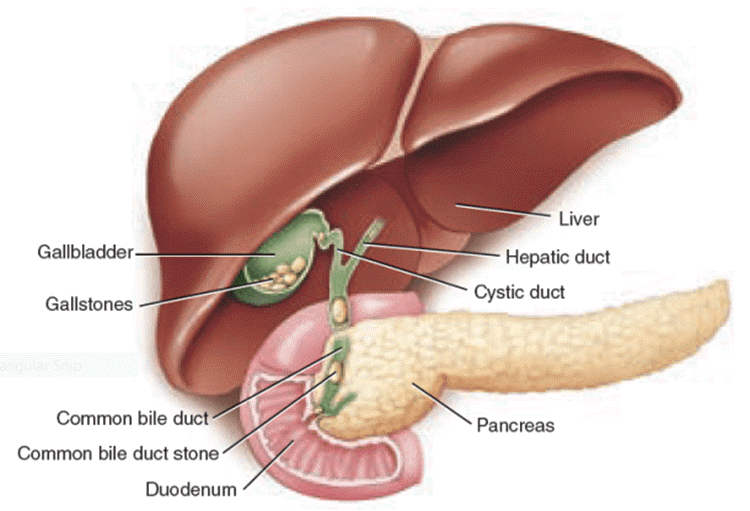 cholelithiasis-and-choledocholithiasis-medical-terminology-blog