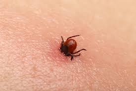 Lyme Disease - Blacklegged Tick
