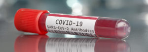 Antibody Test, COVID-19