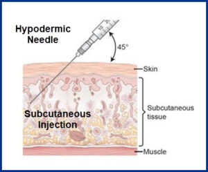 Hypodermic Subcutaneous Injection